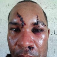 Denuncian miembros del DICAN propina brutal golpiza a motoconcho en Barahona
