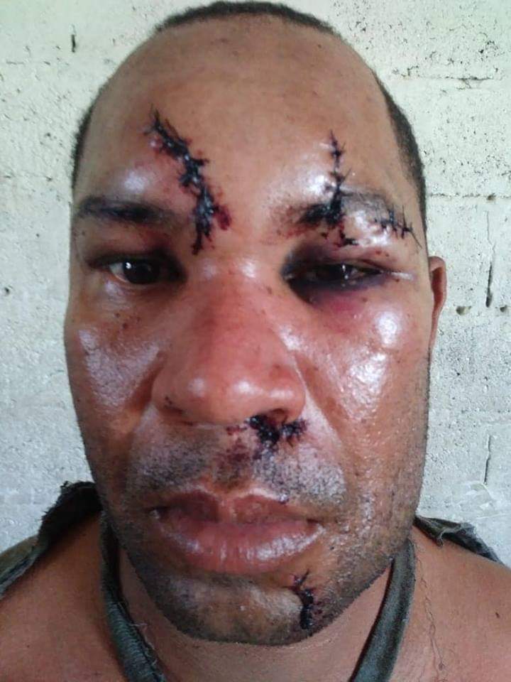 Denuncian miembros del DICAN propina brutal golpiza a motoconcho en Barahona