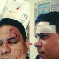 Hospital Darío Contreras se querella contra familiares de paciente agredieron médico