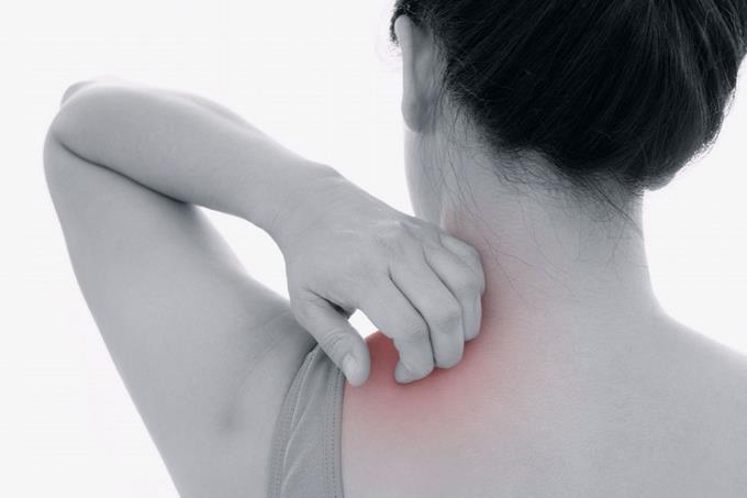 ¿Sabe usted qué es psoriasis?