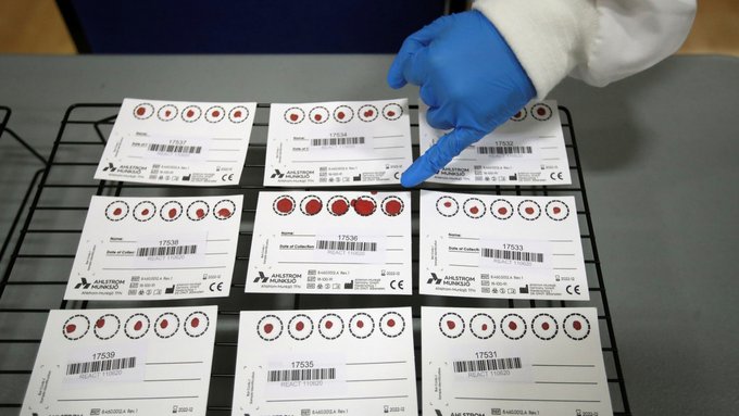 Hombre da positivo al coronavirus 15 veces en menos de tres meses